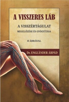 A visszeres láb a visszértágulat megelőzése és gyógyítása